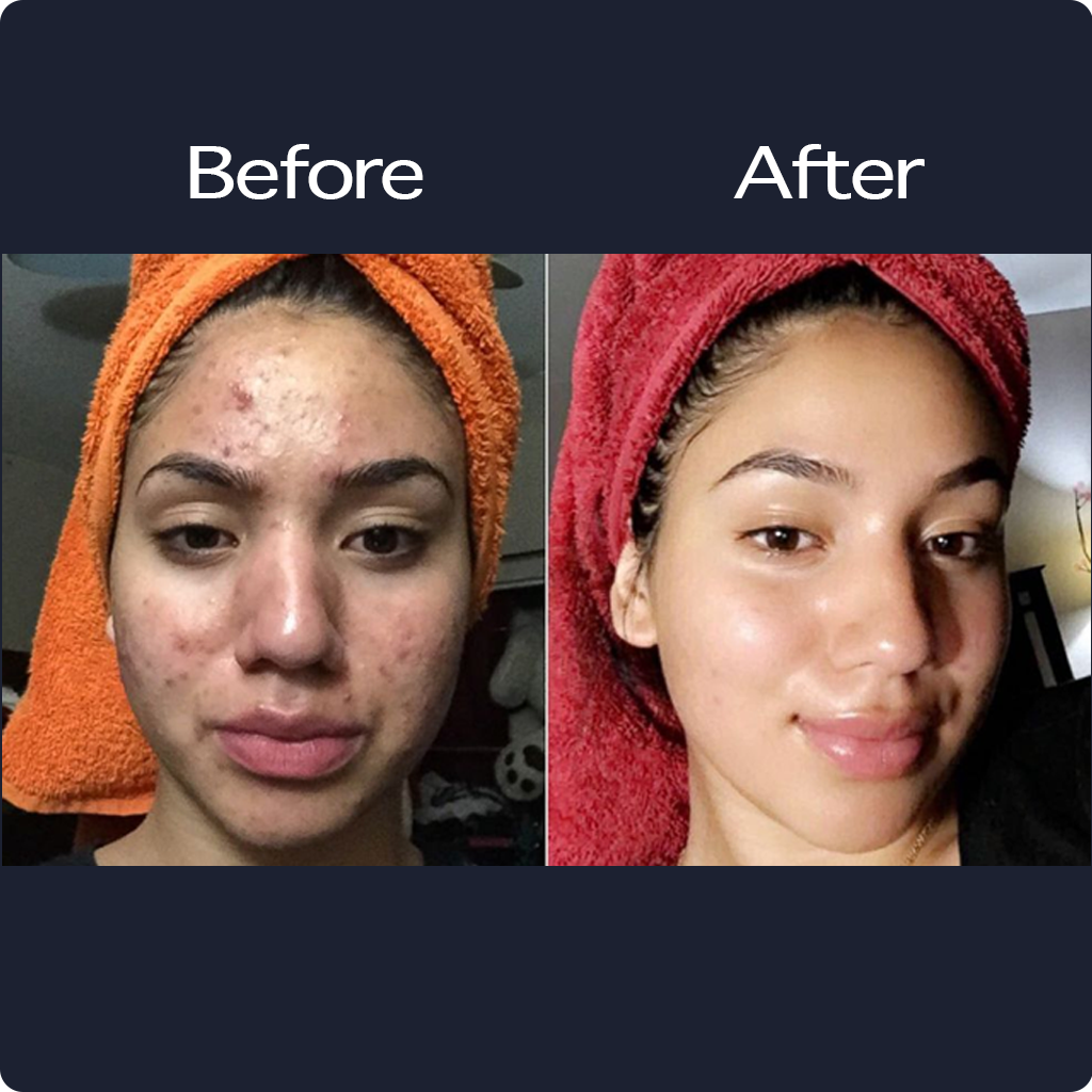 Honest Glow Natural Skin Care