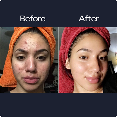 Honest Glow Natural Skin Care